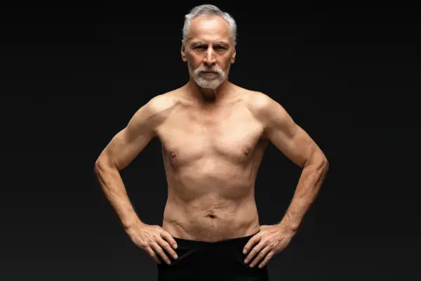 Una visión de la sarcopenia